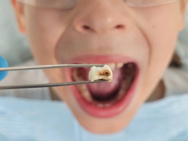 Best Emergency Dental Services for Seniors in Monte Vista, CO